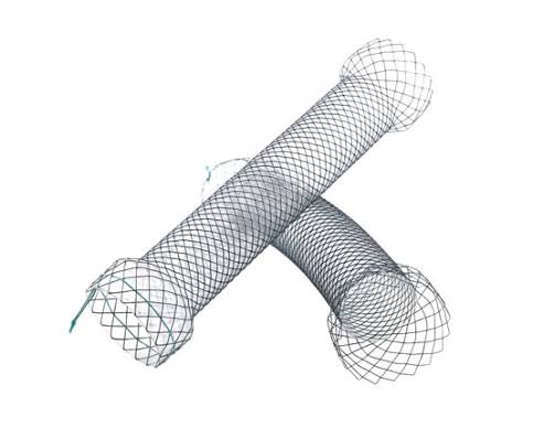 Duodenal and pyloric metallic stent